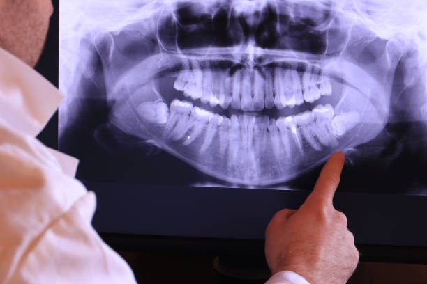 Best Broken Tooth Emergency  in Hartford, IL